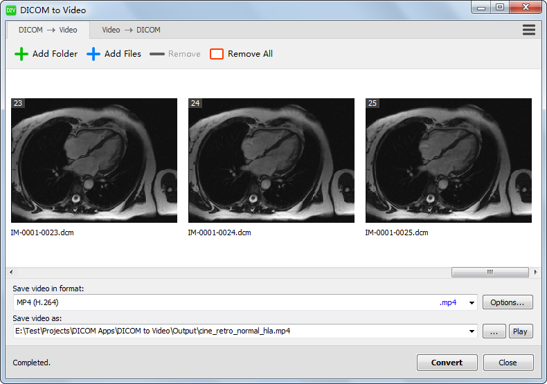 DICOM to Video