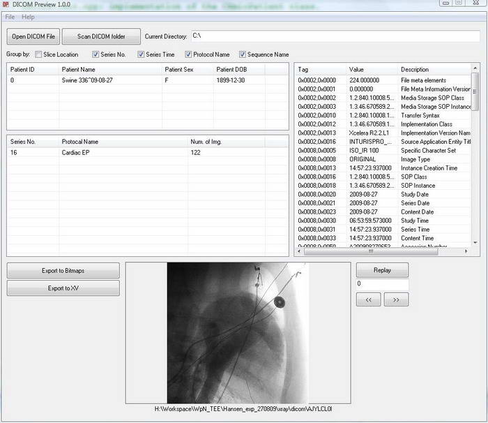 DICOM Preview