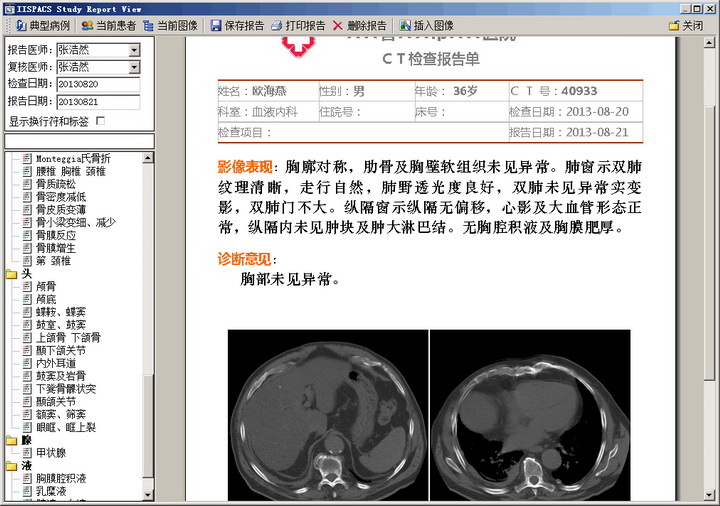 医学PACS&RIS图文报告工作站