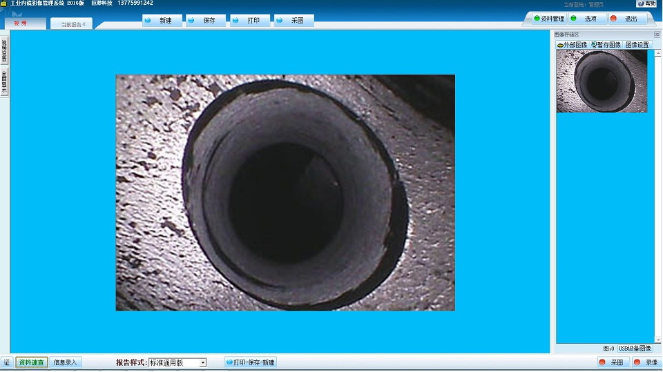 巨渺工业内窥镜影像管理系统