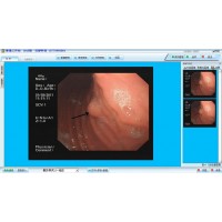 肛肠镜影像工作站