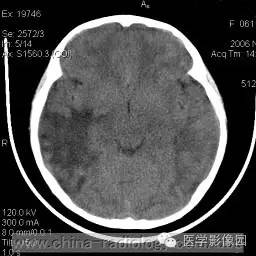 医学CT报告系统